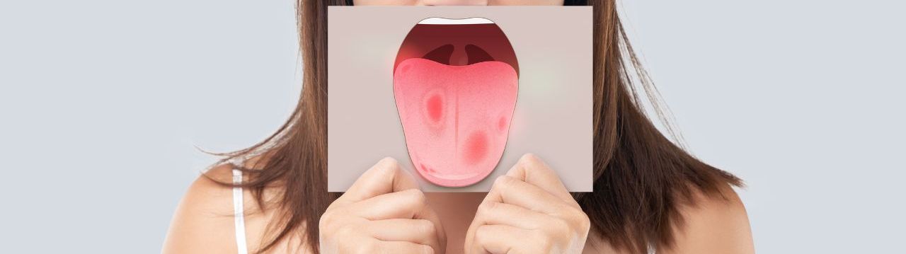 7 symptômes indiquant une maladie de la langue