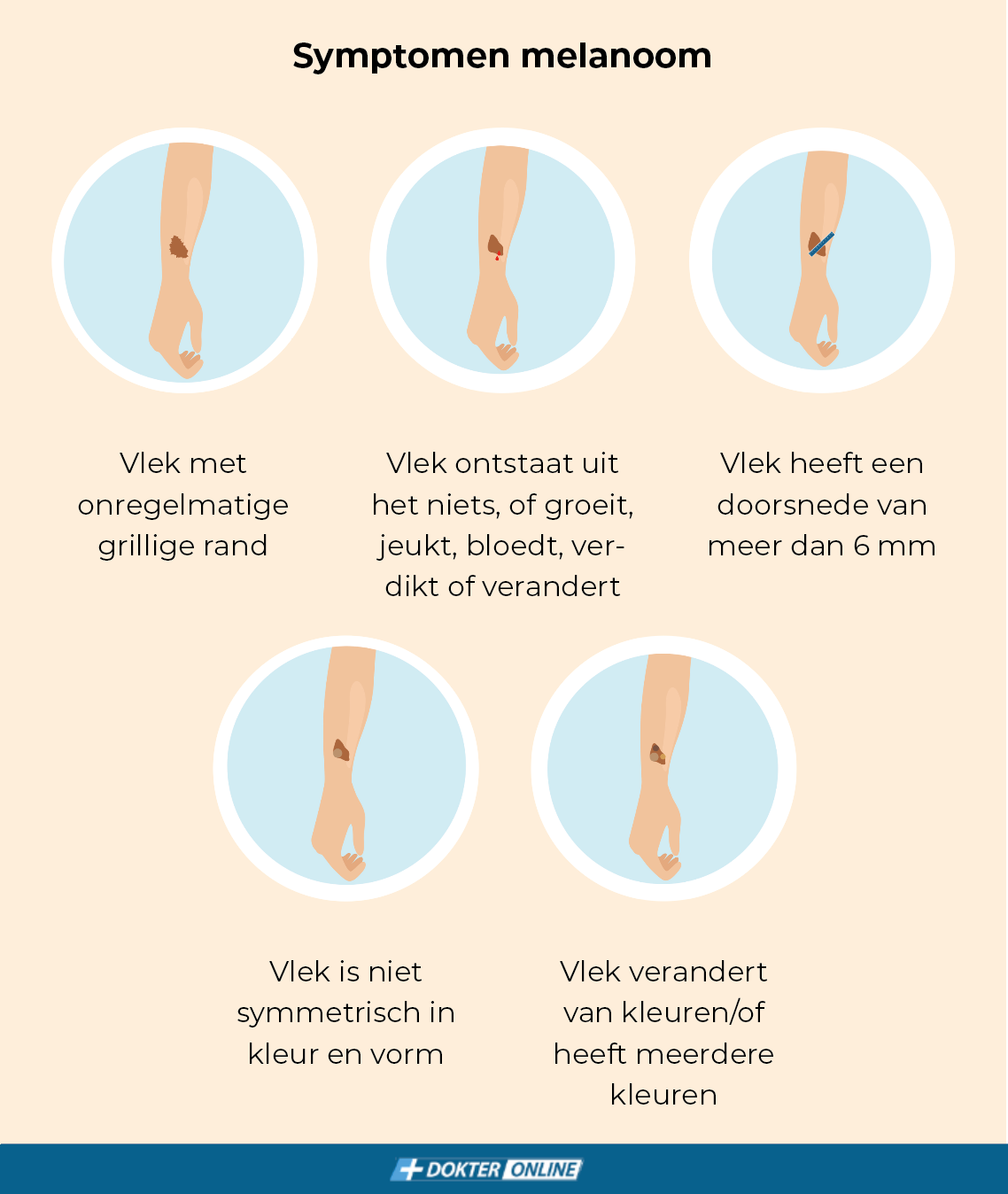 Symptomen melanoom - NL