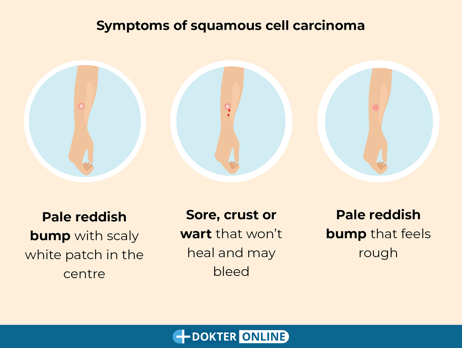 Check for early signs of skin cancer by doing a self-exam - EN4