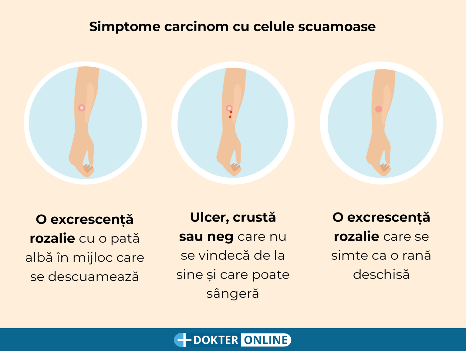 Depistarea timpurie a cancerului de piele prin autoexaminare - RO4