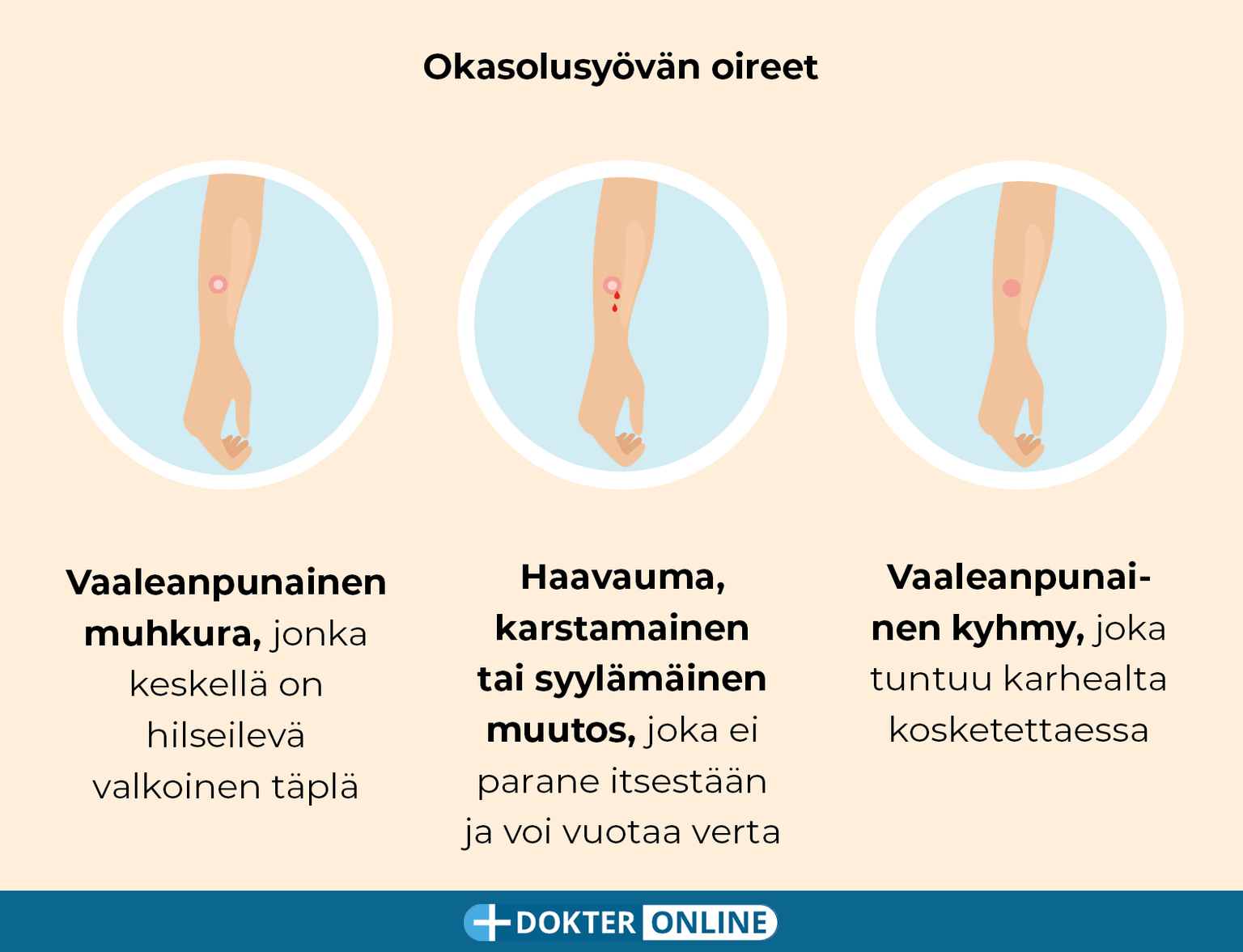 Ihosyövän varhainen havaitseminen itsetutkimuksen avulla - FI4