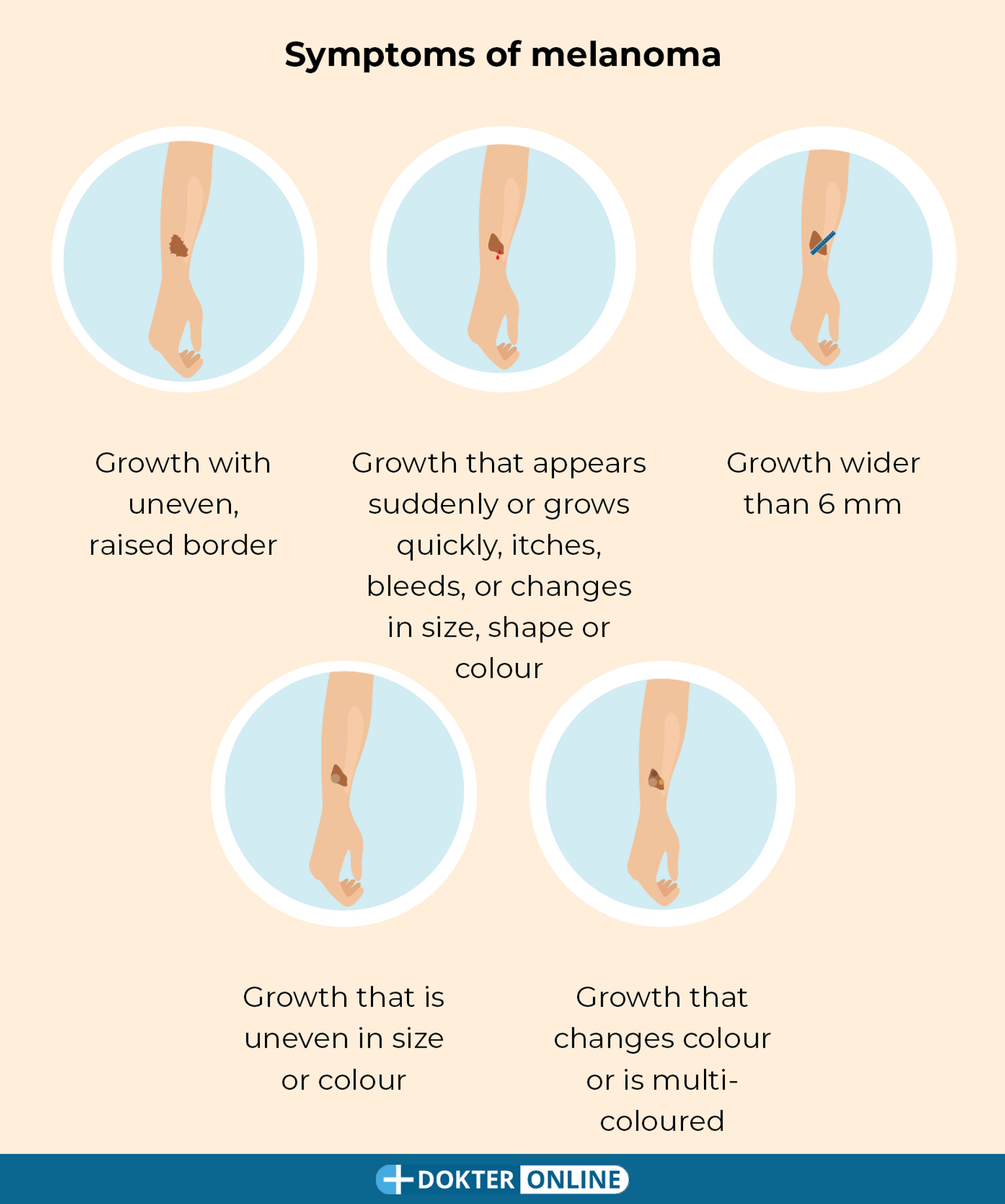 Check for early signs of skin cancer by doing a self-exam - EN5